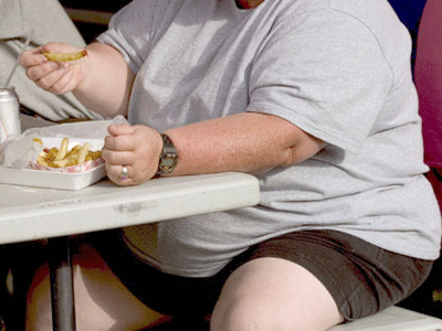 Investigadores hallaron que los costos médicos de una persona obesa son 2,741 dólares más al año (en dólares de 2005) que si no fuera obesa.